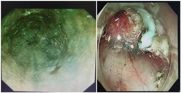 20200403_101604_521139.jpg 222.jpg